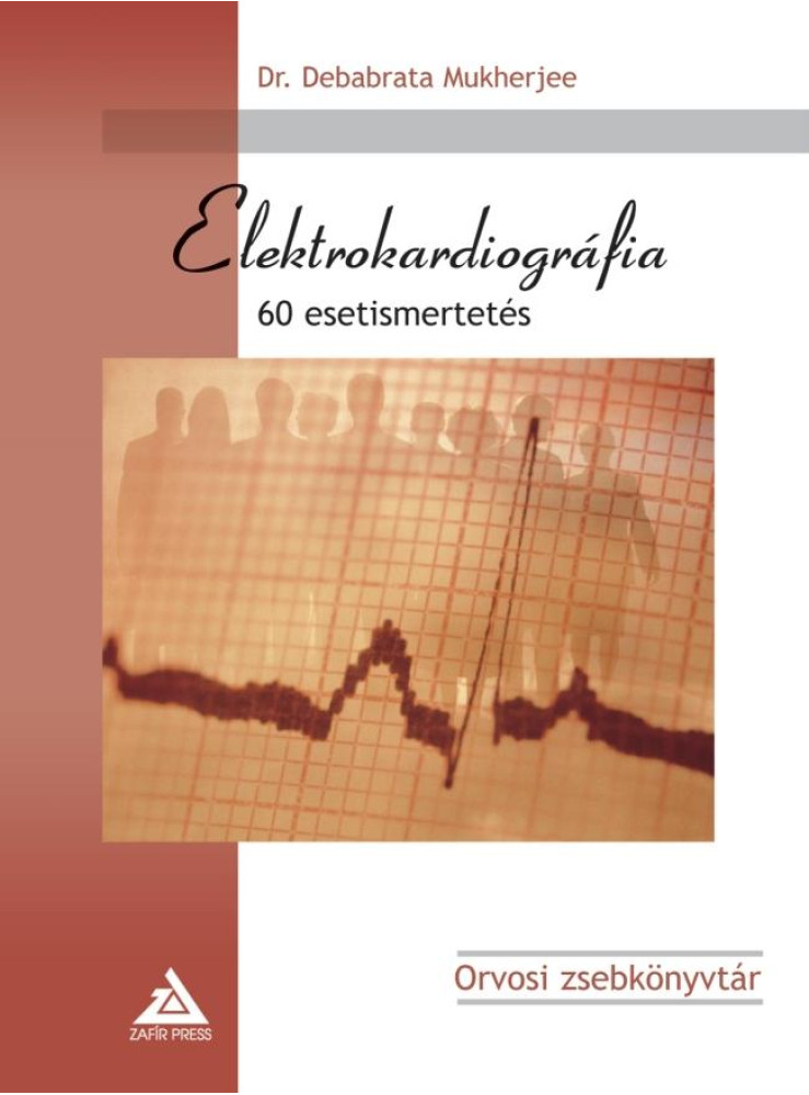 ELEKTROKARDIOGRÁFIA - 60 ESETISMERTETÉS ELEKTROKARDIOGRÁFIA - 60 ESETISMERTETÉS