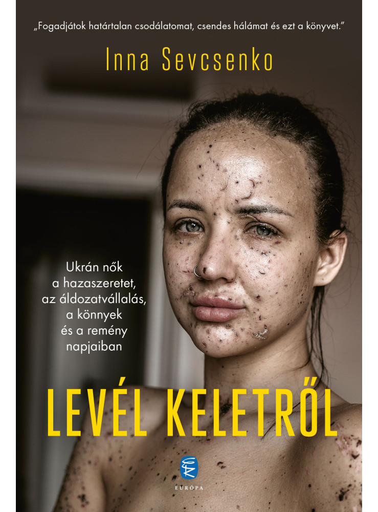 LEVÉL KELETRŐL - UKRÁN NŐK A HAZASZERETET, AZ ÁLDOZATVÁLLALÁS....NAPJAIBAN. LEVÉL KELETRŐL - UKRÁN NŐK A HAZASZERETET, AZ ÁLDOZATVÁLLALÁS....NAPJAIBAN.